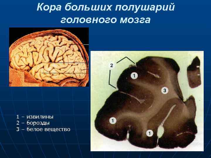 Кора больших полушарий головного мозга 1 – извилины 2 – борозды 3 – белое