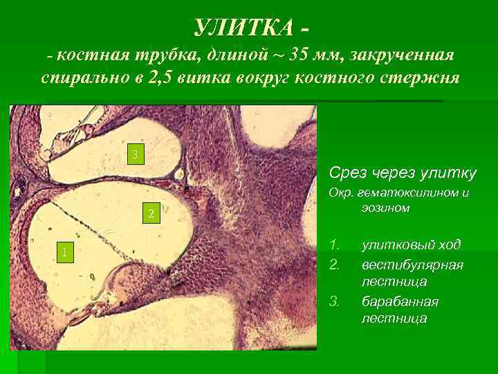 УЛИТКА - костная трубка, длиной ~ 35 мм, закрученная спирально в 2, 5 витка