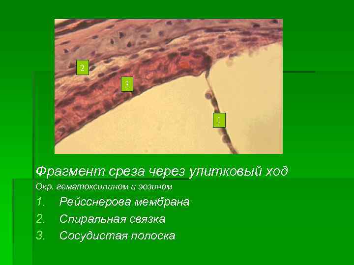 2 3 1 Фрагмент среза через улитковый ход Окр. гематоксилином и эозином 1. 2.