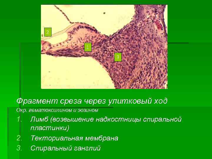 2 1 3 Фрагмент среза через улитковый ход Окр. гематоксилином и эозином 1. 2.
