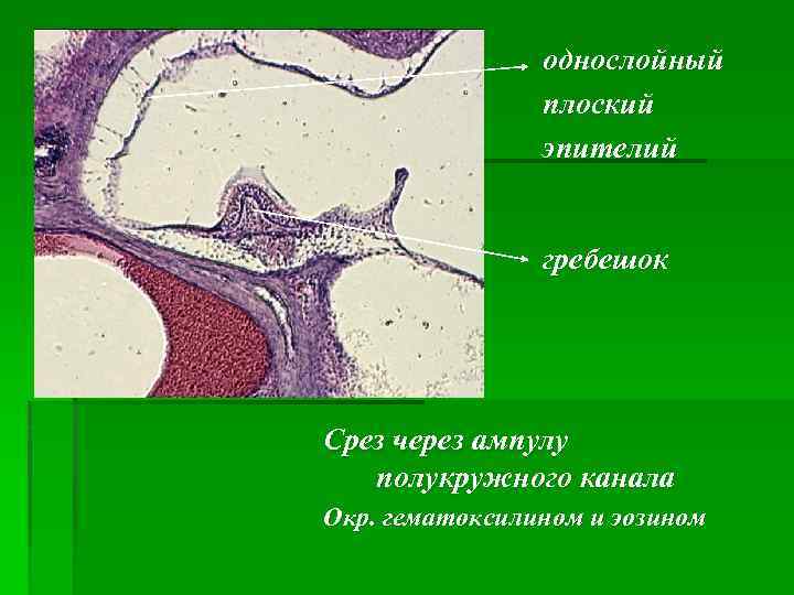однослойный плоский эпителий гребешок Срез через ампулу полукружного канала Окр. гематоксилином и эозином 