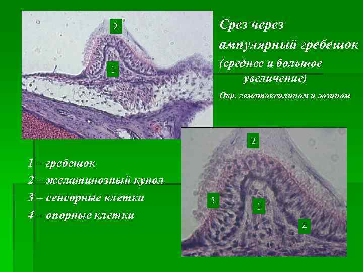 Срез через ампулярный гребешок 2 (среднее и большое увеличение) 1 Окр. гематоксилином и эозином