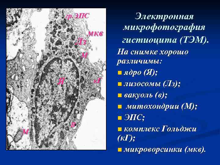 гр. ЭПС Лз мкв М Я М к. Г В Электронная микрофотография гистиоцита (ТЭМ).