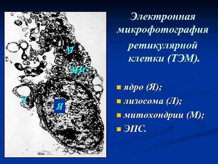 М Электронная микрофотография ретикулярной клетки (ТЭМ). ЭПС n ядро (Я); Л Я n лизосома