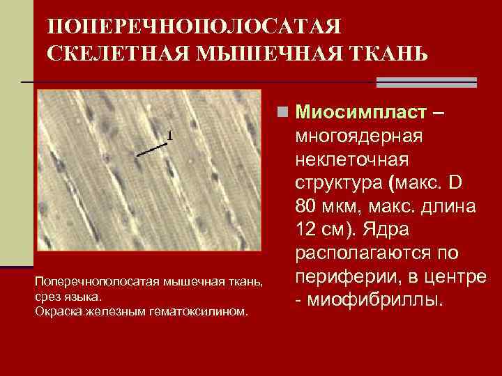 ПОПЕРЕЧНОПОЛОСАТАЯ СКЕЛЕТНАЯ МЫШЕЧНАЯ ТКАНЬ n Миосимпласт – Поперечнополосатая мышечная ткань, срез языка. Окраска железным
