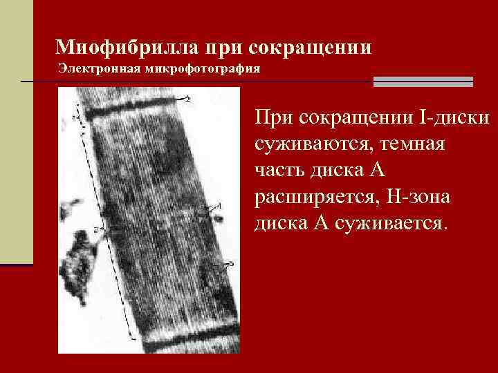 Миофибрилла при сокращении Электронная микрофотография При сокращении I-диски суживаются, темная часть диска А расширяется,