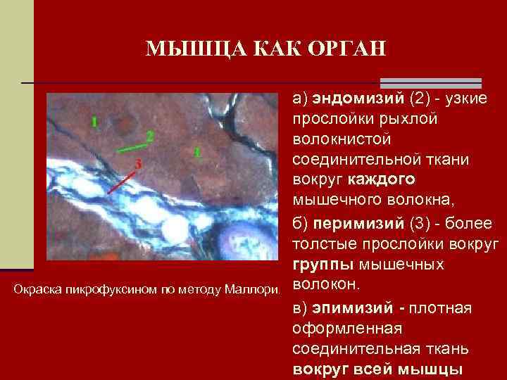 МЫШЦА КАК ОРГАН Окраска пикрофуксином по методу Маллори. а) эндомизий (2) - узкие прослойки