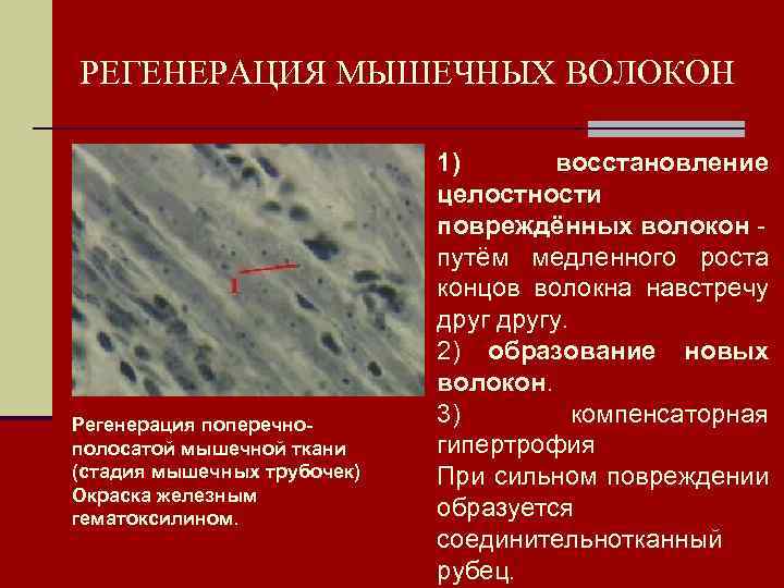 РЕГЕНЕРАЦИЯ МЫШЕЧНЫХ ВОЛОКОН Регенерация поперечнополосатой мышечной ткани (стадия мышечных трубочек) Окраска железным гематоксилином. 1)