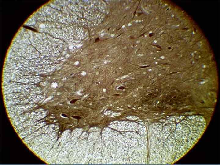 Микроглия строение и функции. Мезотелий гистология препарат. Импрегнация серебром гистология методика. Окраска импрегнация серебром гистология. Спинной мозг окраска импрегнация серебром.