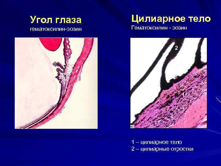 Угол глаза гематоксилин-эозин Цилиарное тело Гематоксилин - эозин 2 1 1 1 – цилиарное