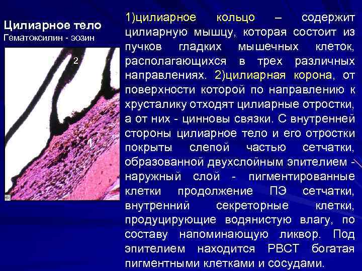 Цилиарное тело Гематоксилин - эозин 2 1 1)цилиарное кольцо – содержит цилиарную мышцу, которая