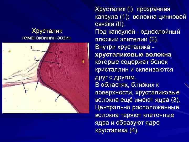 Хрусталик гематоксилин-эозин Хрусталик (I) прозрачная капсула (1); волокна цинновой связки (II). Под капсулой -