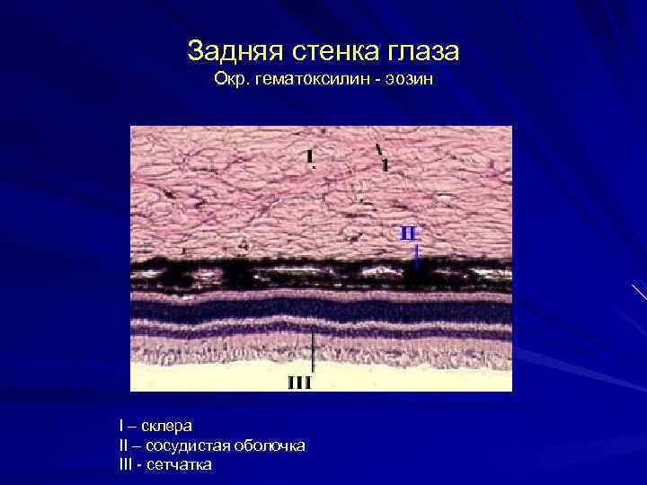 Задняя стенка глаза Окр. гематоксилин - эозин I – склера II – сосудистая оболочка