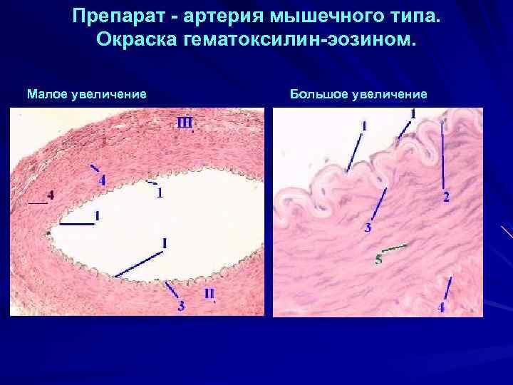 Рисунок артерии мышечного типа