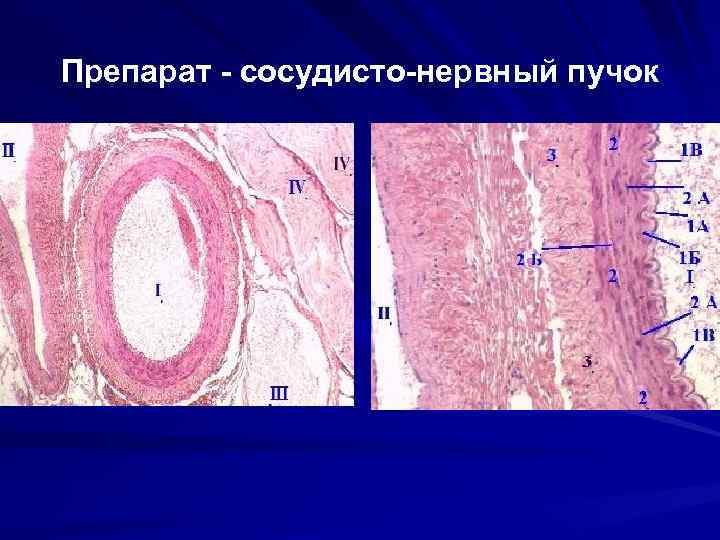 Сосудистый пучок. Сосудисто нервный пучок гистология. Сосудисто нервный пучок препарат. Нервно сосудистый пучок гистология препарат. Нервный пучок гистология препарат.