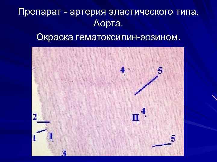 Препарат артерия эластического типа. Аорта. Окраска гематоксилин эозином. 