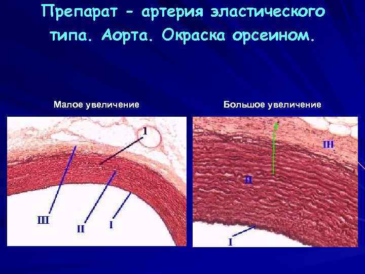 Аорта рисунок гистология