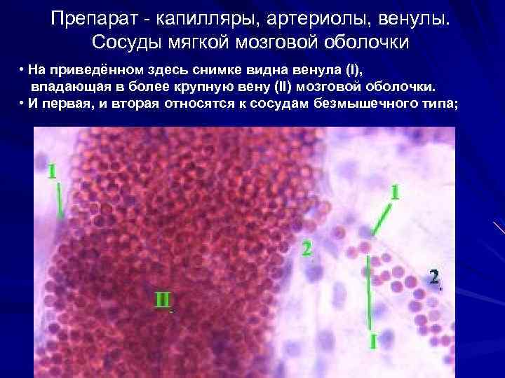 Вены селезенки по строению стенки относятся к венам безмышечного типа