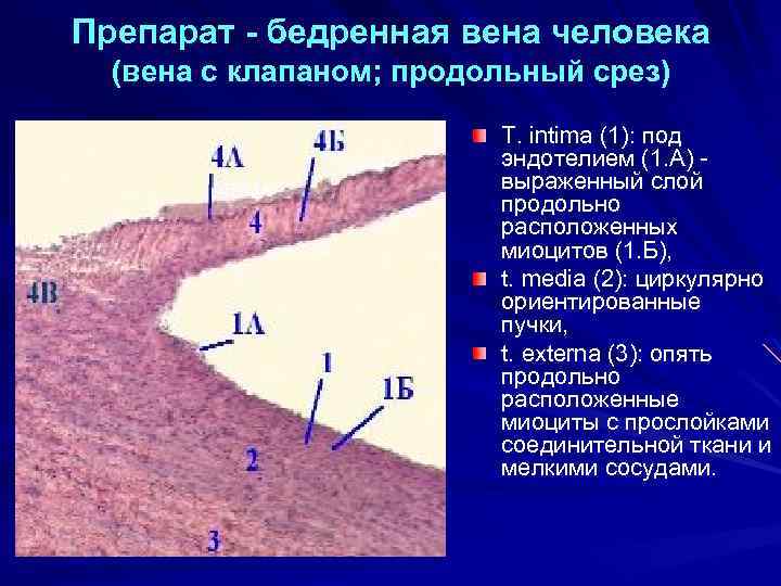 Препарат - бедренная вена человека (вена с клапаном; продольный срез) T. intima (1): под