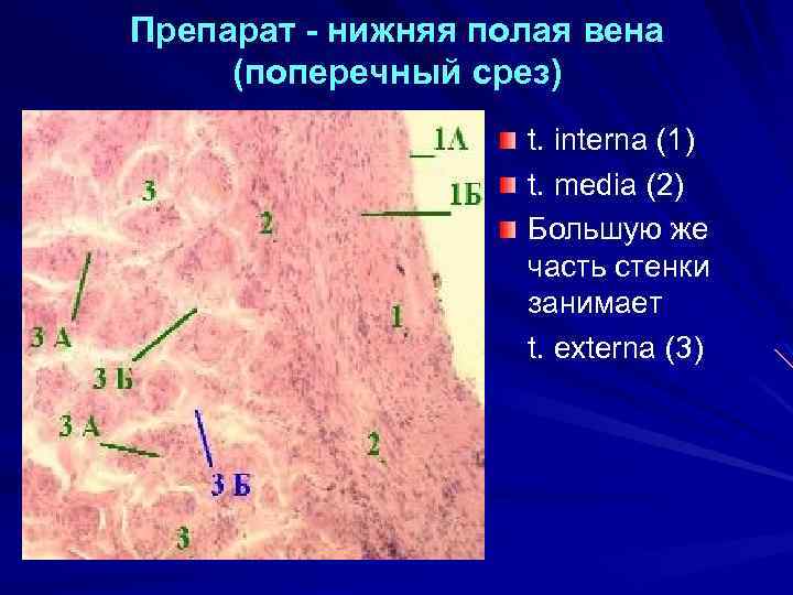 Верхняя полая вена гистология рисунок - 81 фото