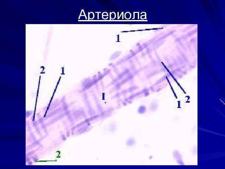 Артериола 