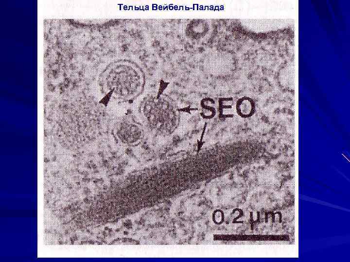 Тельца Вейбель-Палада 