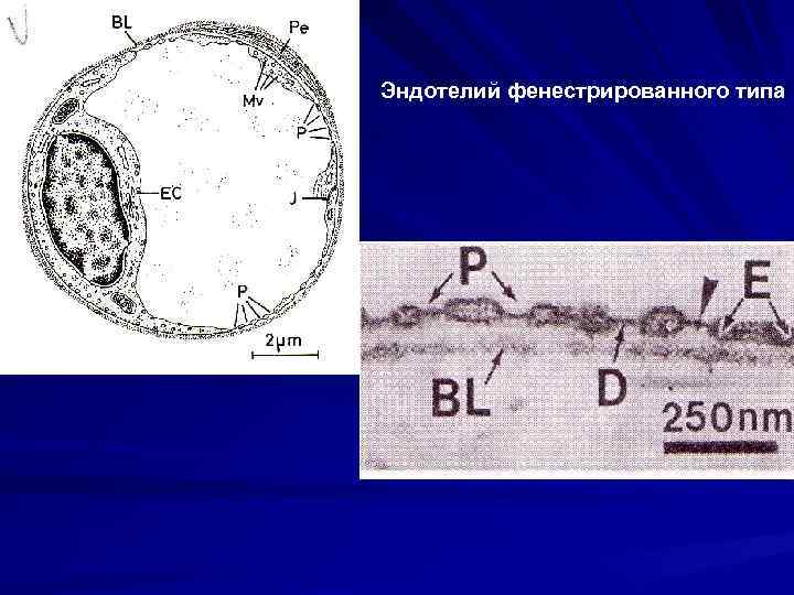 Эндотелий фенестрированного типа 