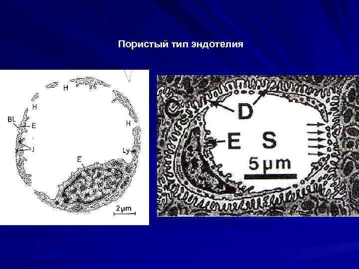 Пористый тип эндотелия 