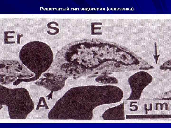 Решетчатый тип эндотелия (селезенка) 
