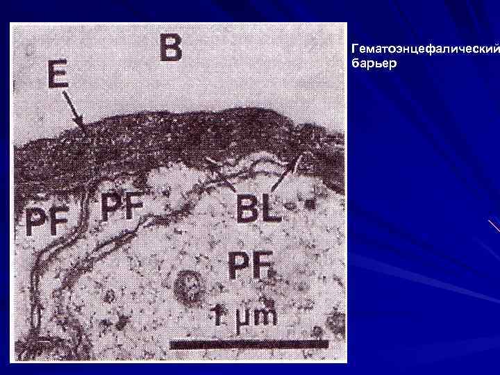 Гематоэнцефалический барьер 