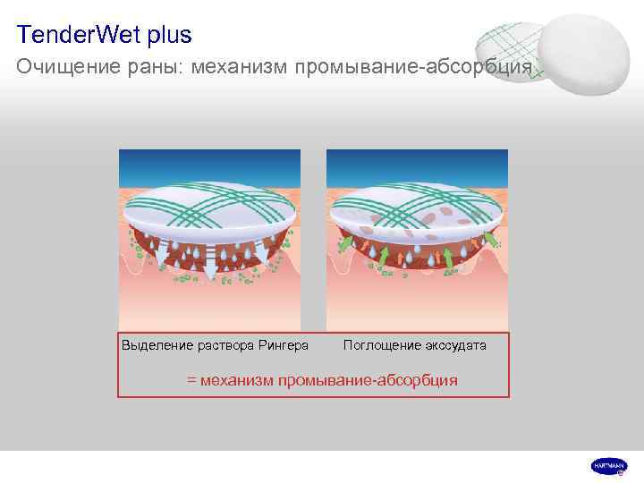 Tender. Wet plus Очищение раны: механизм промывание-абсорбция Выделение раствора Рингера Поглощение экссудата = механизм
