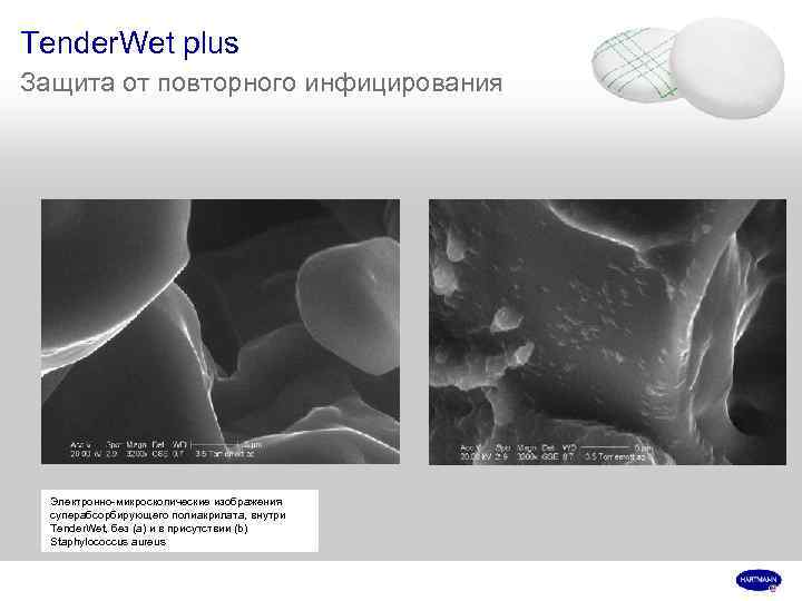 Tender. Wet plus Защита от повторного инфицирования Электронно-микроскопические изображения суперабсорбирующего полиакрилата, внутри Tender. Wet,