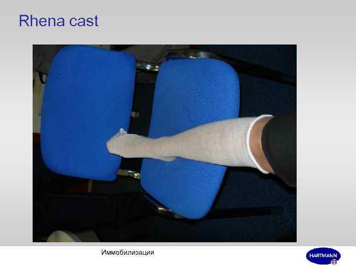 Rhena cast Иммобилизация 