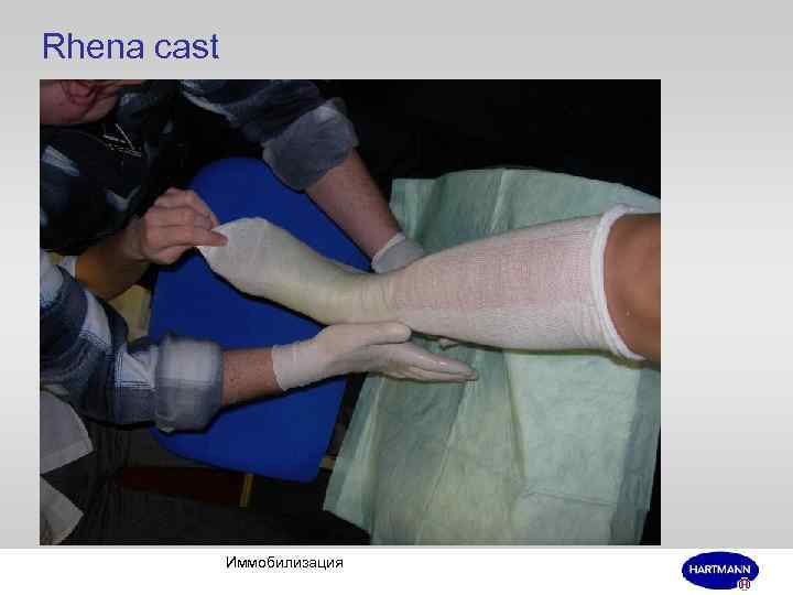 Rhena cast Иммобилизация 