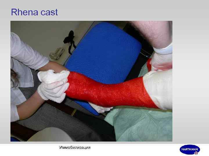 Rhena cast Иммобилизация 