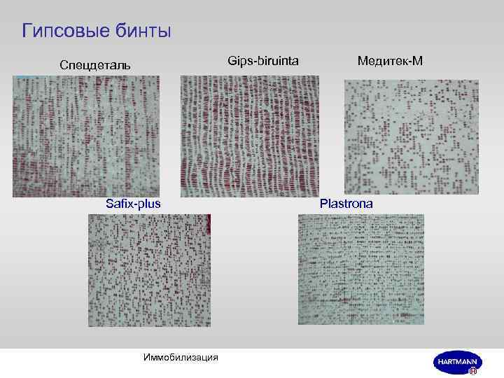 Гипсовые бинты Gips-biruinta Спецдеталь Safix-plus Иммобилизация Медитек-М Plastrona 