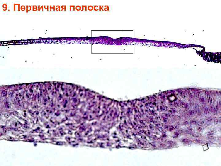 9. Первичная полоска 