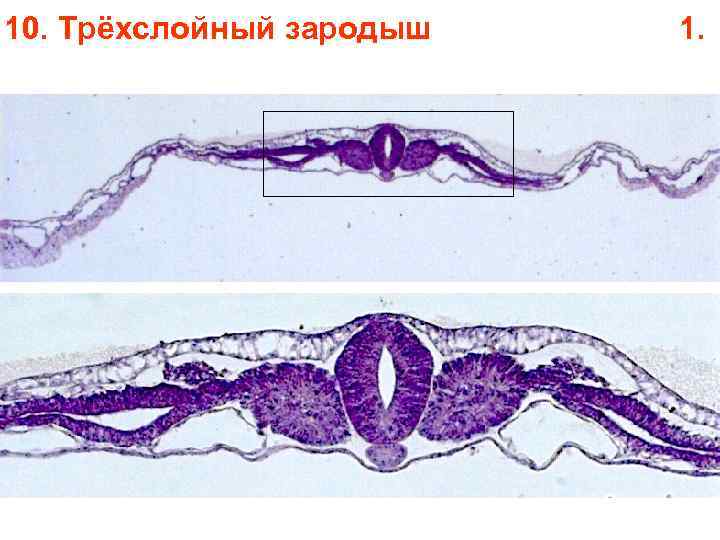 10. Трёхслойный зародыш 1. 