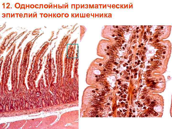 12. Однослойный призматический эпителий тонкого кишечника 