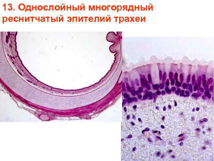 13. Однослойный многорядный реснитчатый эпителий трахеи 