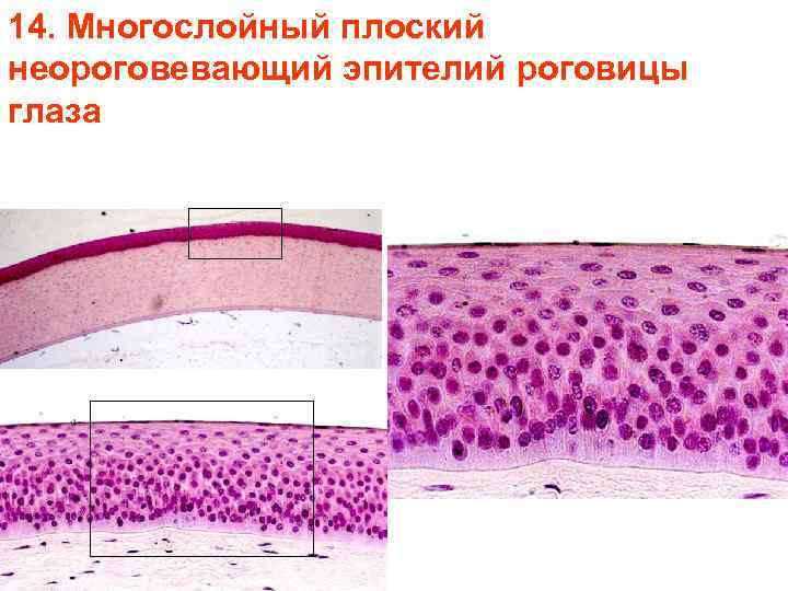 14. Многослойный плоский неороговевающий эпителий роговицы глаза 