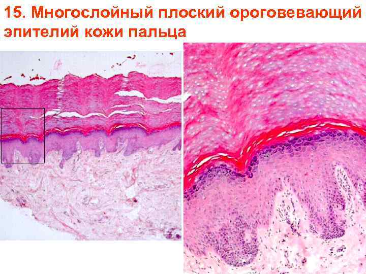 15. Многослойный плоский ороговевающий эпителий кожи пальца 