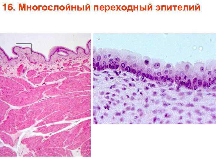 16. Многослойный переходный эпителий 