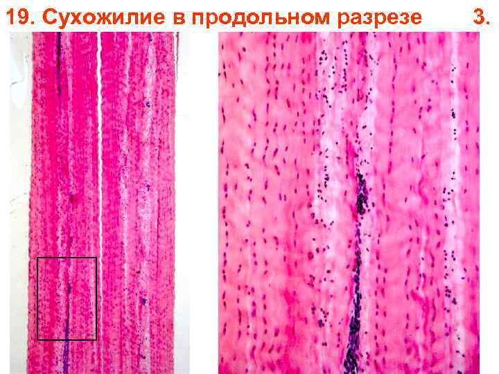 19. Сухожилие в продольном разрезе 3. 