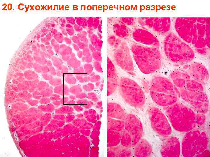 20. Сухожилие в поперечном разрезе 