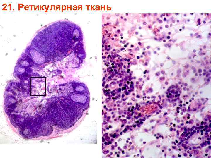 21. Ретикулярная ткань 