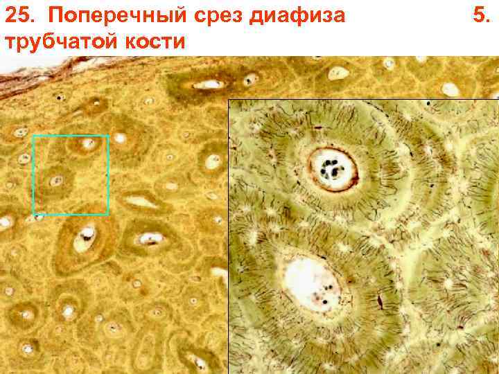 25. Поперечный срез диафиза трубчатой кости 5. 