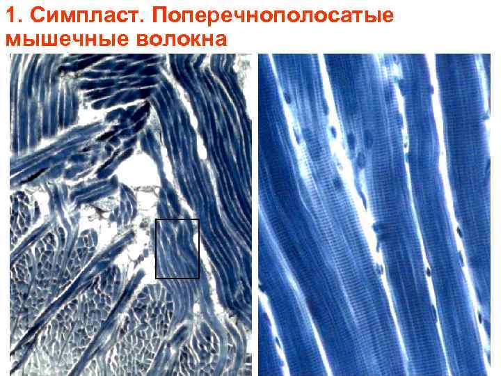 1. Симпласт. Поперечнополосатые мышечные волокна 