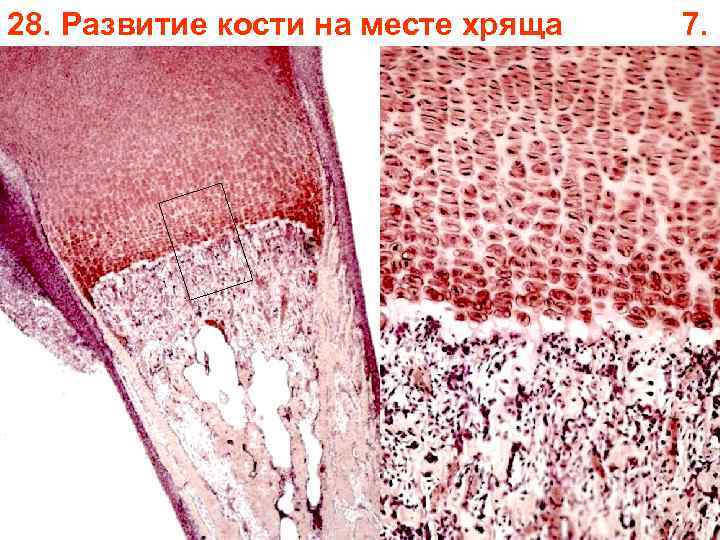 28. Развитие кости на месте хряща 7. 