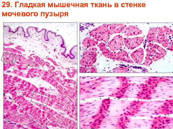 29. Гладкая мышечная ткань в стенке мочевого пузыря 